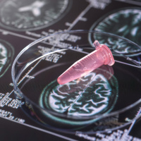 Neuroprotektion durch Cannabis: Hoffnung bei Parkinson  Alzheimer