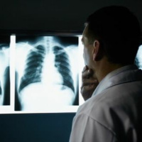 Neue Erfolge mit medizinischem Cannabis in der Krebstherapie