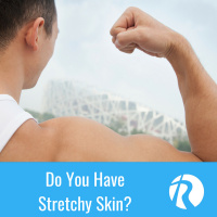 Do You Have Stretchy Skin