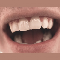 Tell Me Why...we have accents