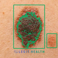 Legit Health: inteligencia artificial para la detección de enfermedades de la piel