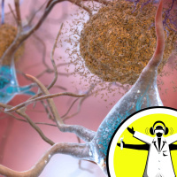 Naked Scientists 19.07.09 - Alzheimers Disease: Facts and Fiction