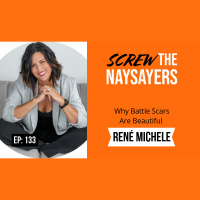 Ep 133 Why Battle Scars Are Beautiful | René Michele 