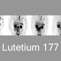Baidwan_Hari_10-2_Lutetium177