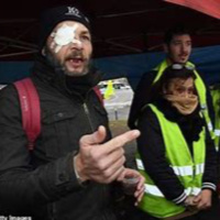 Protestors Lose Eyes, Floods In Nepal amp Just My Opinion