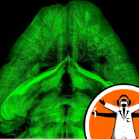 See-through rats bare their brains