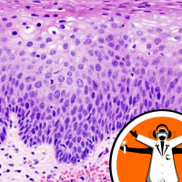 Cancer-killing immune cells