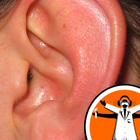 Tinnitus therapy trial success