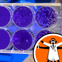 AI to Detect Tuberculosis