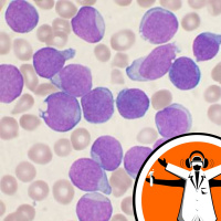 New Leukemia Therapy