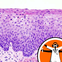 New test for cervical cancer