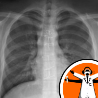 BSF 2012 - Seeing through Clothes and Water Voles