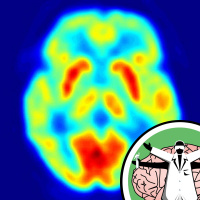 The Naked Scientists unravel the connections in your brain