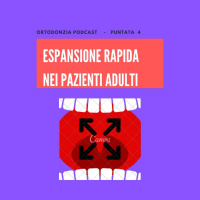 Espansione Rapida negli adulti (senza chirurgia)