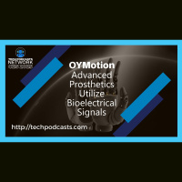 OYMotions Innovations in Human-Machine Interfaces for Prosthetics