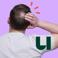 748. Waarom worden mannen altijd kaal op de kruin?