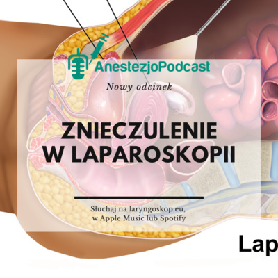 Anestezjopodcast
