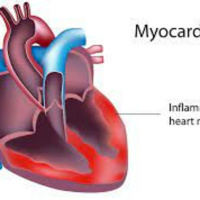 Episode 199: FIRST SNEAK PEEK OF EPISODE #199: (No) Brains, TrAns, and (Electric) Automobiles 