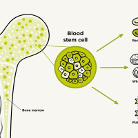 17: What is a stem cell? (patient information)