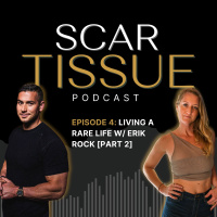 Living a Rare Life with Erik Rock [Part 2]