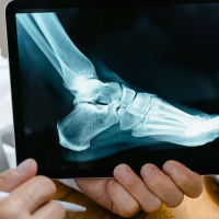 For Better Or Worse, Changes Happen