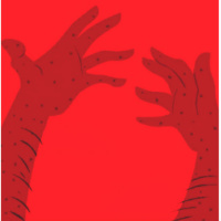 עשר מכות: שחין עם ענת שרון בלייס