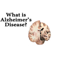 Episode 36 - Understanding Alzheimers and How to Keep Your Brain Healthy