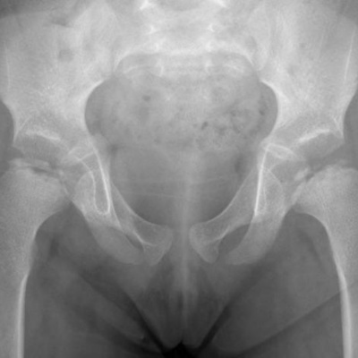 Nic Treadwells Storyville