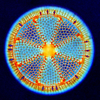 Diatom Dmitry