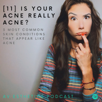 [11] is your acne really acne?