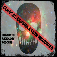 CCR Episode 3 Lateral CXR