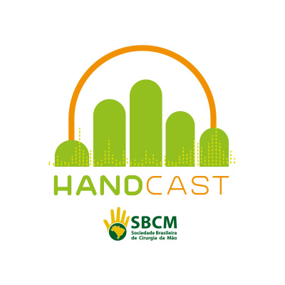 Handcast - Sbcm