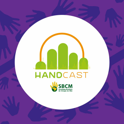 Handcast - Sbcm