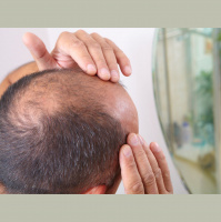 So You Think Youre An Adult: My Partner is going bald, it looks awful