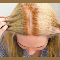 So You Think Youre An Adult: I bleached my hair  its now orange, I cant face work video calls