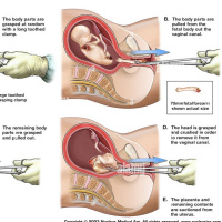 A Message to Pro Abortionists