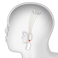 Neuralink Progress Update — Summer 2020