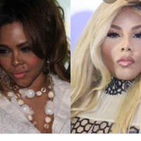 Melanin vs skin whitening