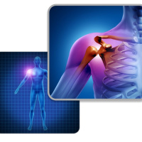 Sports Injury with the Upper Extremities
