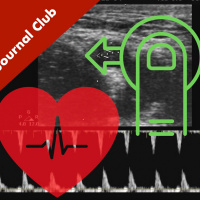 Doppler US For Pulse Checks