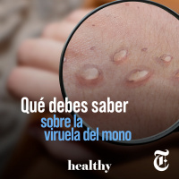 Episodio 65:  Qué debes saber sobre la viruela del mono