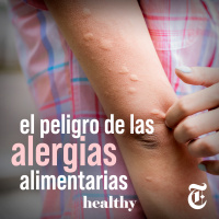 Episodio 34: El peligro de las alergias alimentarias