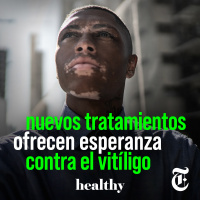 Episodio 20: Nuevos tratamientos ofrecen esperanza contra el vitíligo