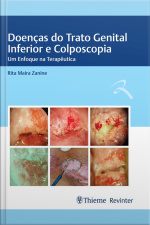 Doenças Do Trato Genital Inferior E Colposcopia: Um Enfoque Na Terapêutica
