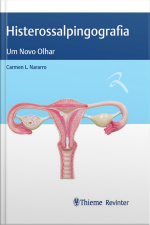 Histerossalpingografia: Um Novo Olhar