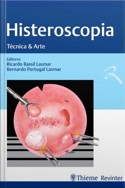 Histeroscopia: Técnica  Arte