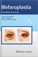 Blefaroplastia: Em Realidade Aumentada