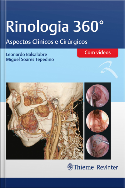 Rinologia 360°: Aspectos Clínicos E Cirúrgicos