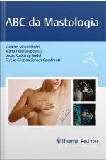 Abc Da Mastologia