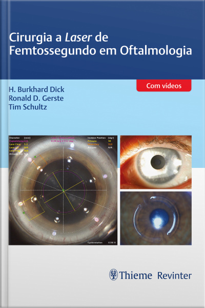Cirurgia A Laser De Femtossegundo Em Oftalmologia